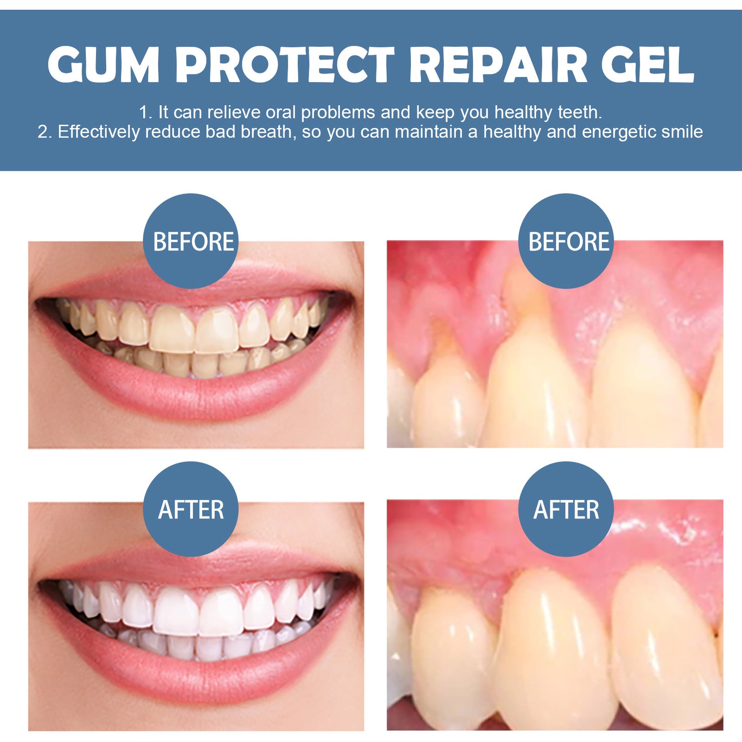 Gum Repair Gel